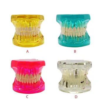 Nuimamas Dantų Dantų Modelį Su Restauravimo Tiltas Dantų Odontologas Naujų Stomatologas Lavinimo Dantų Mokymo Studijų